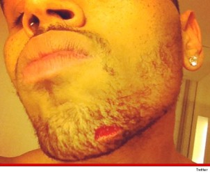 Drake vs. Chris Brown Fight: The Aftermath