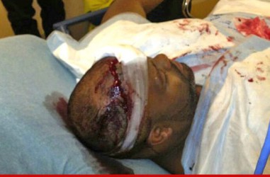 Drake vs. Chris Brown Fight: The Aftermath