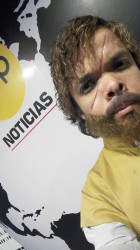 GoT: Απίστευτη ομοιότητα Tyrion Lannister cosplay με τον Peter Dinklage